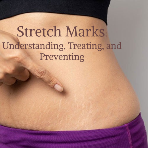 Understanding Stretch Marks: Causes, Treatments, and Prevention – Pokonut